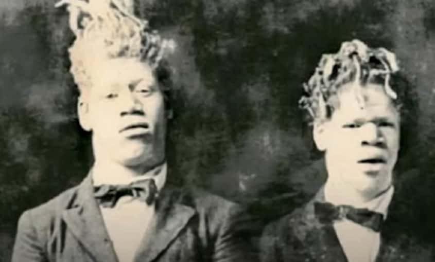 Twisted Facts About the Muse Brothers, The Heartbreaking Circus Act ...